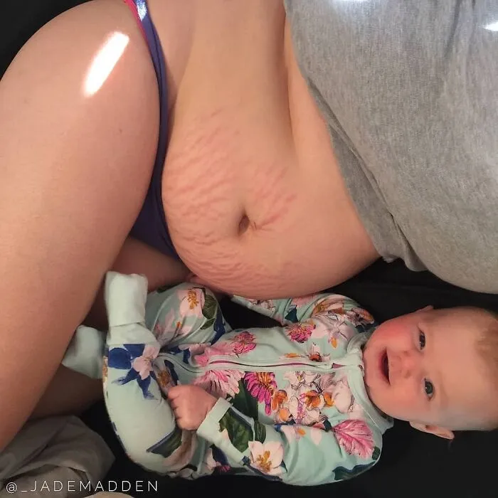 The Only Post Baby Bodies I See On Instagram And The “Perfect” Ones