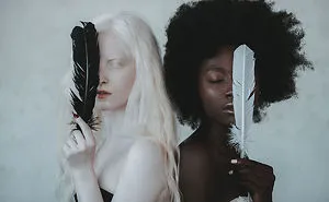 Photographer Created A Concept Called Sun And Moon With Albino And Black Woman