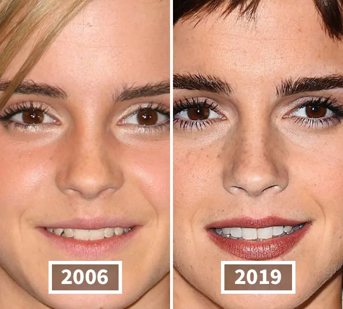 Emma Watson