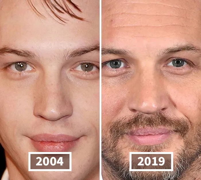 Tom Hardy