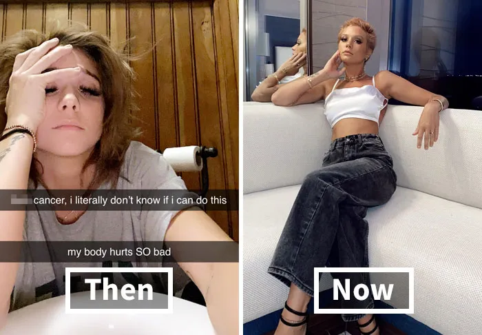People Take ‘How It Started Vs. How It's Going’ Challenge To Another Level Of Wholesomeness By Sharing Their Cancer Stories (30 Pics)