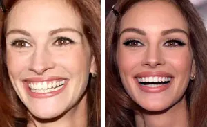 Someone Is Editing Celeb Pics To Fit Today's Influencer Beauty Standards And People Have Mixed Feelings (30 Pics)