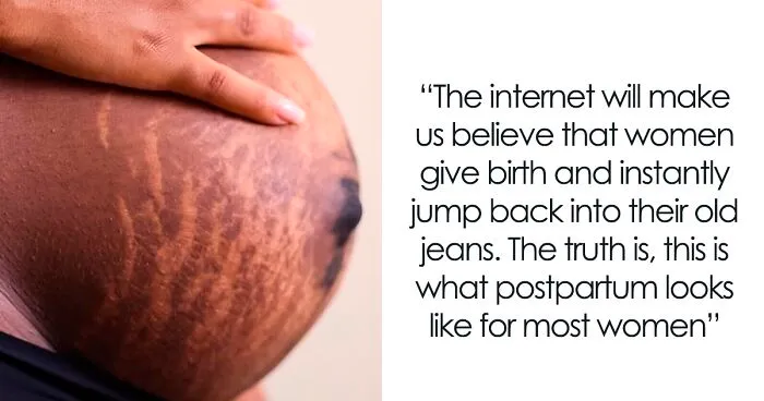 Women Are Sharing Honest And Raw Photos Of Postpartum Bodies That Show The Reality No One Talks About (28 Pics)