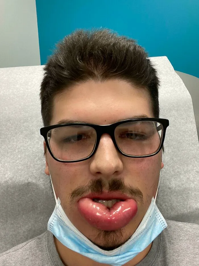 Got Stung On The Lip By A Wasp Getting The Ole’ Christmas Tree Out. 2020 Has Been Fun For Sure