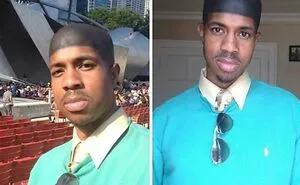 50 Tragic Hair Accidents, As Shared In This Online Community