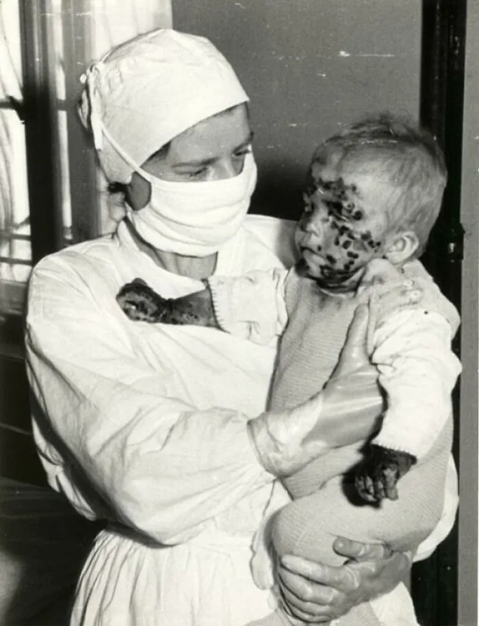A Nurse With A Sick Child During Smallpox Epidemic, Wrocław, Poland, 1963