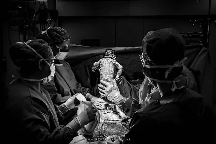 Raw And Powerful Side Of Birth Captured In My 30 Photos