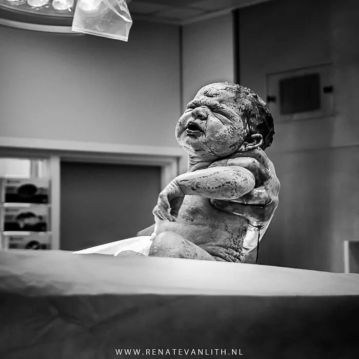 Raw And Powerful Side Of Birth Captured In My 30 Photos