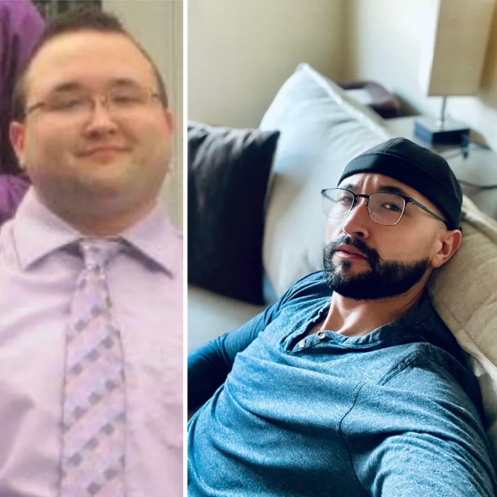 23 vs. 31 - Perdí Peso (72 Kilos) Hace 7 Años. Mi Cabello Pasó De La Parte Superior De Mi Cabeza A Mi Cara Y Todavía Estoy Tratando De Encontrar Mi Apariencia, Pero Me Sentí Bien Hoy
