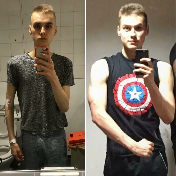 99lbs > 150lbs. Anorexia, My Recovery