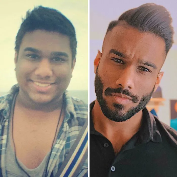 Face Progress: I Ran Into An Old College Friend Today Who Literally Refused To Believe It Was Me Because I Am "Unrecognizable"