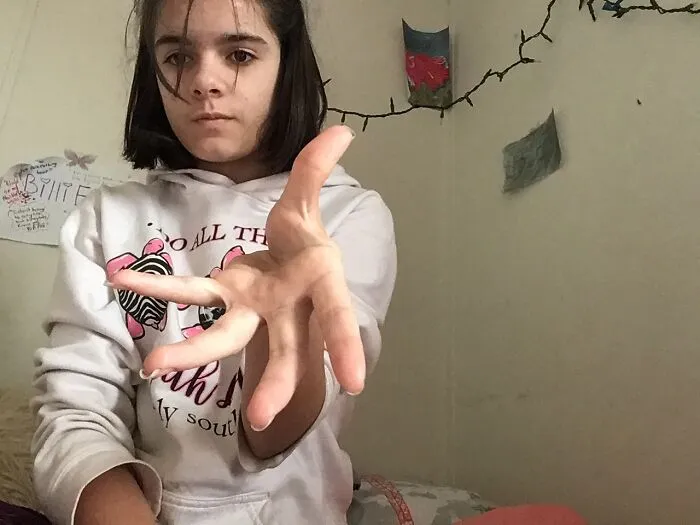 I Can Dislocate My Thumb