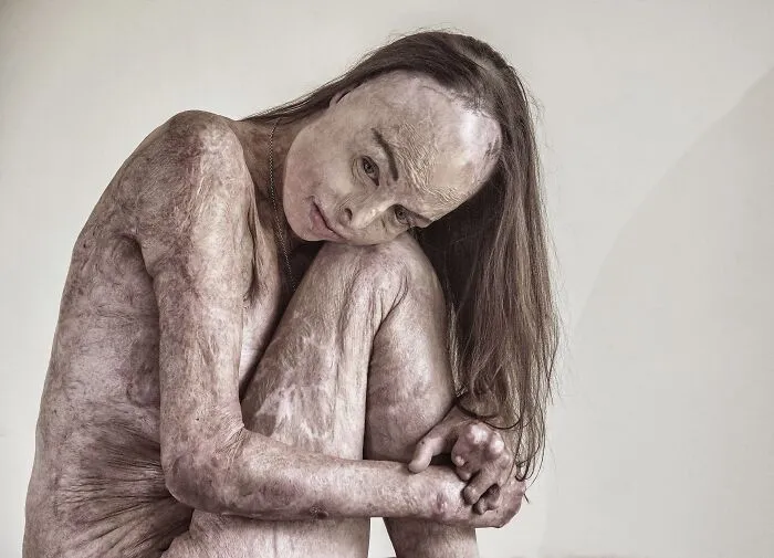 The Skin I'm In
