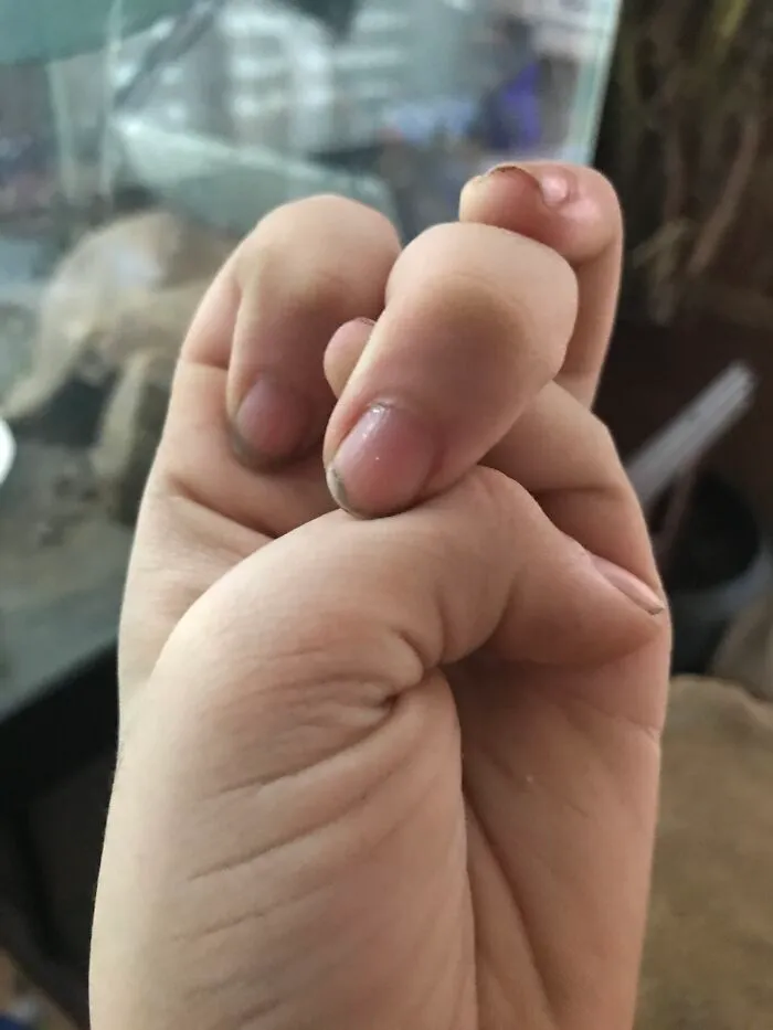 I Can Do The Finger Knot Thing