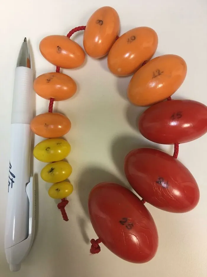 Estaba en una sala de examinación médica. Mi médico no sabía qué era