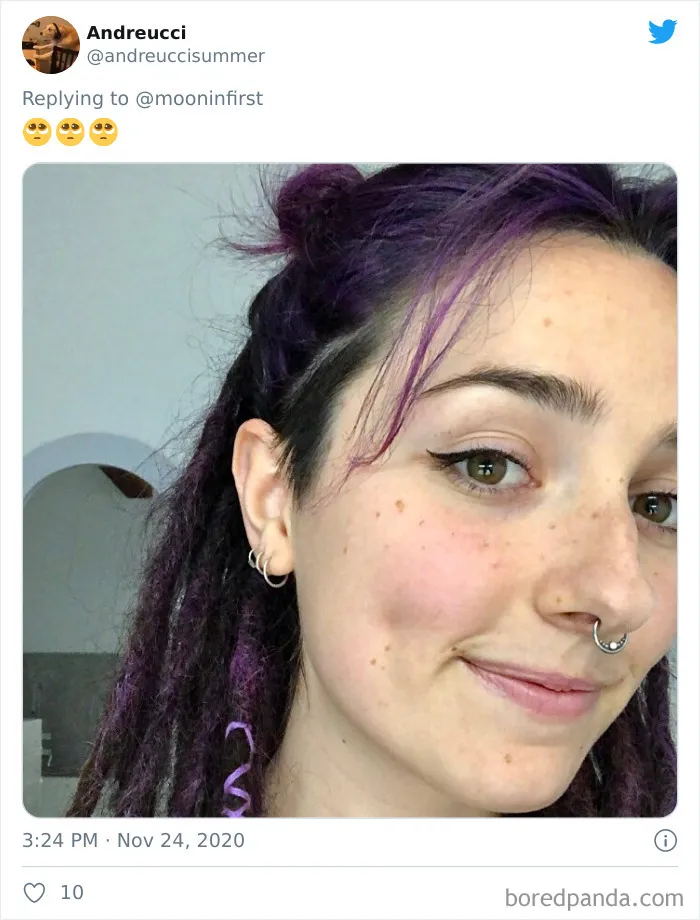 Women Are Posting Their Noses That Look Like "Before" Photos (30 New Pics)