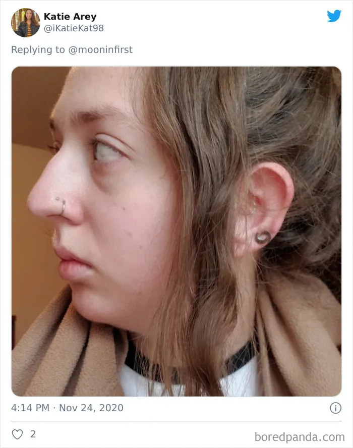 Women Are Posting Their Noses That Look Like "Before" Photos (30 New Pics)