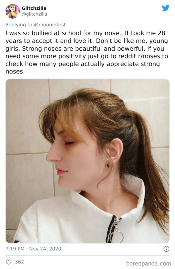 Women Are Posting Their Noses That Look Like "Before" Photos (30 New Pics)