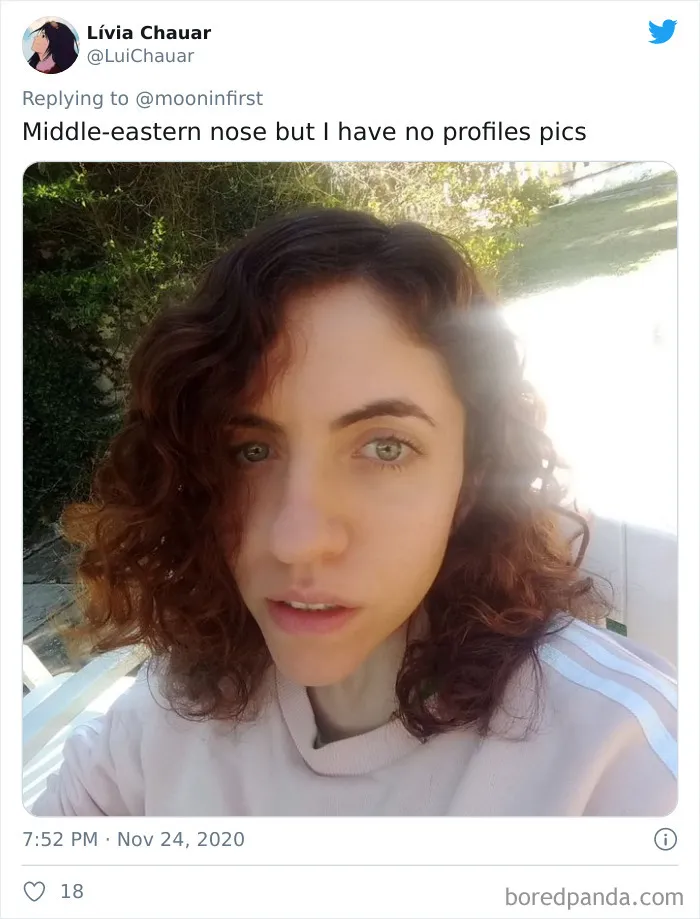 Women Are Posting Their Noses That Look Like "Before" Photos (30 New Pics)