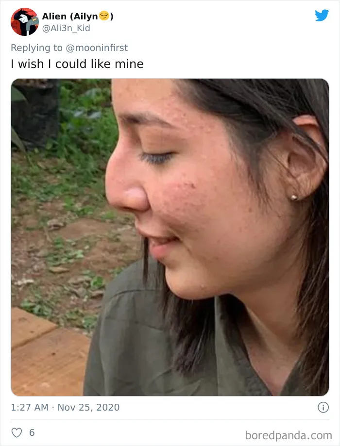 Women Are Posting Their Noses That Look Like "Before" Photos (30 New Pics)