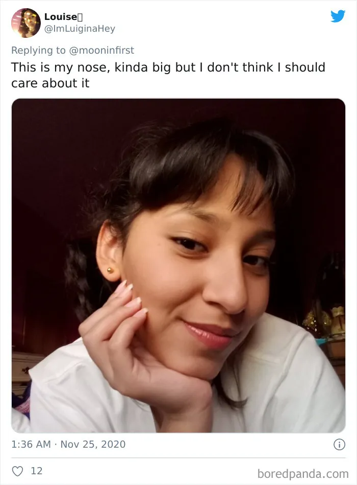 Women Are Posting Their Noses That Look Like "Before" Photos (30 New Pics)