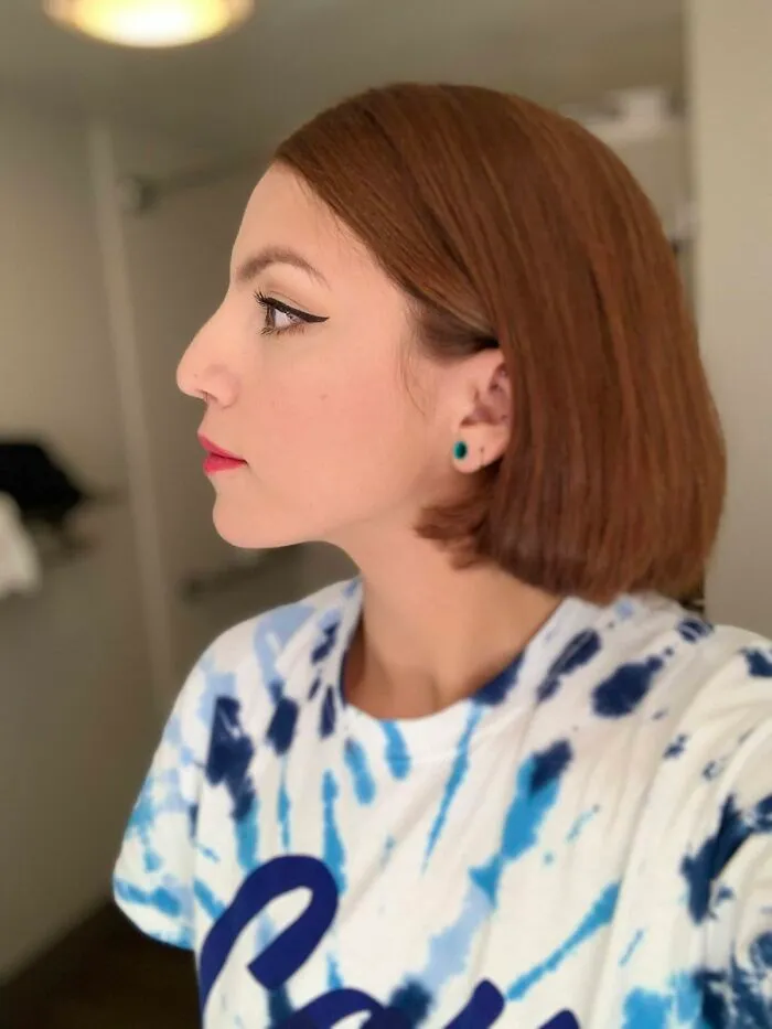 Women Are Posting Their Noses That Look Like "Before" Photos (30 New Pics)