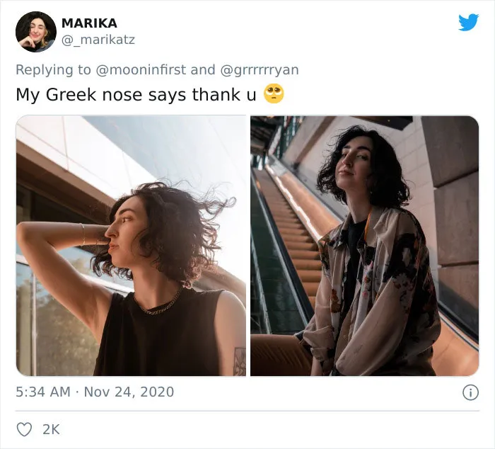 Women Are Posting Their Noses That Look Like "Before" Photos (30 New Pics)