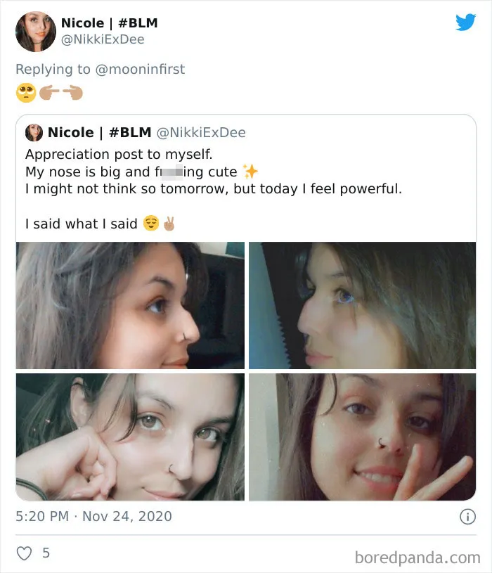 Women Are Posting Their Noses That Look Like "Before" Photos (30 New Pics)