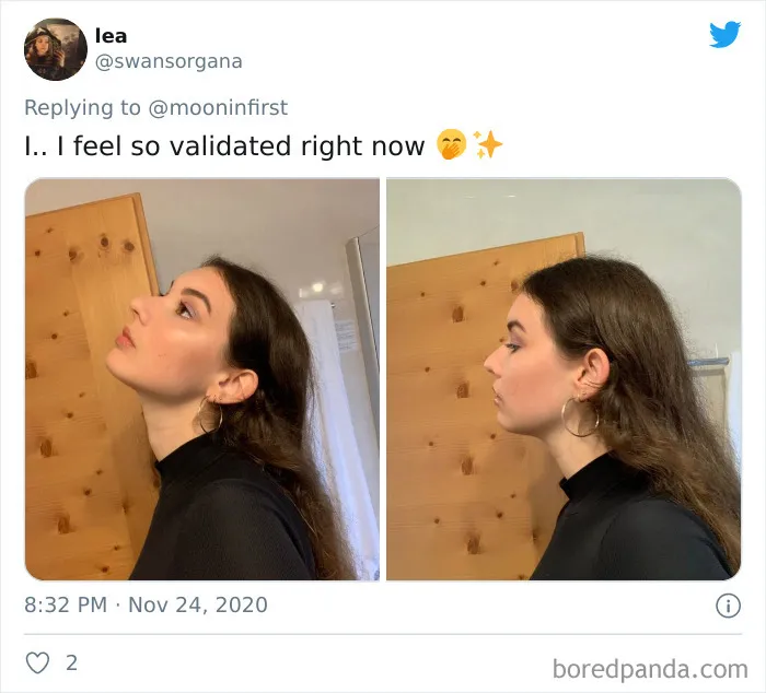 Women Are Posting Their Noses That Look Like "Before" Photos (30 New Pics)