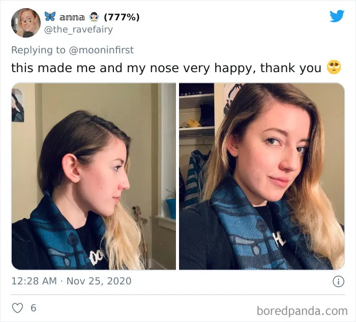 Women Are Posting Their Noses That Look Like "Before" Photos (30 New Pics)