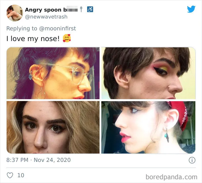 Women Are Posting Their Noses That Look Like "Before" Photos (30 New Pics)