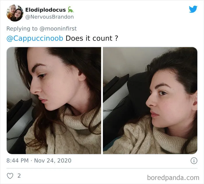 Women Are Posting Their Noses That Look Like "Before" Photos (30 New Pics)