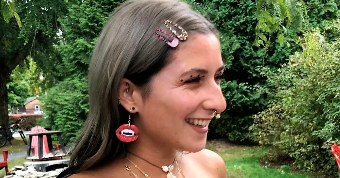Women Are Posting Their Noses That Look Like "Before" Photos (30 New Pics)