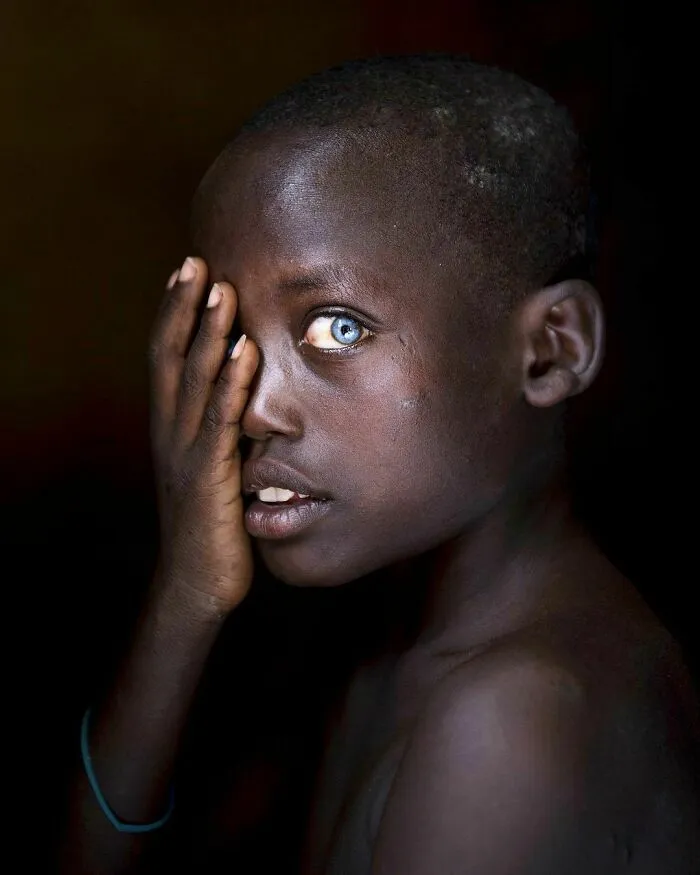 Ethiopia