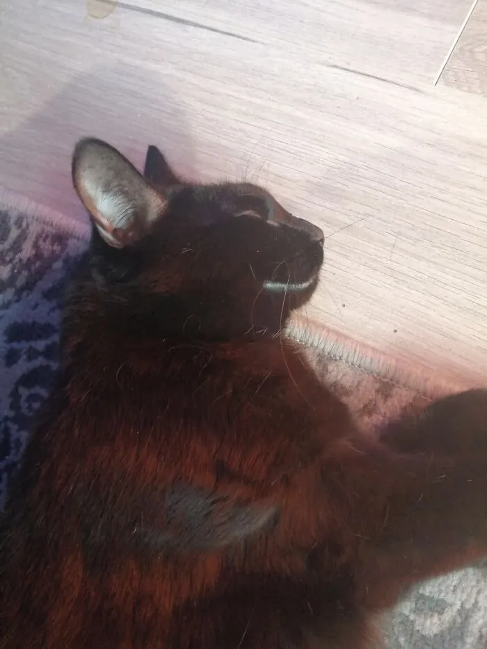 Ronnie Has A Life Long Eye Condition, She Has To Take Steroids Twice A Day. But Even In This Crappy Time, She Is Happy