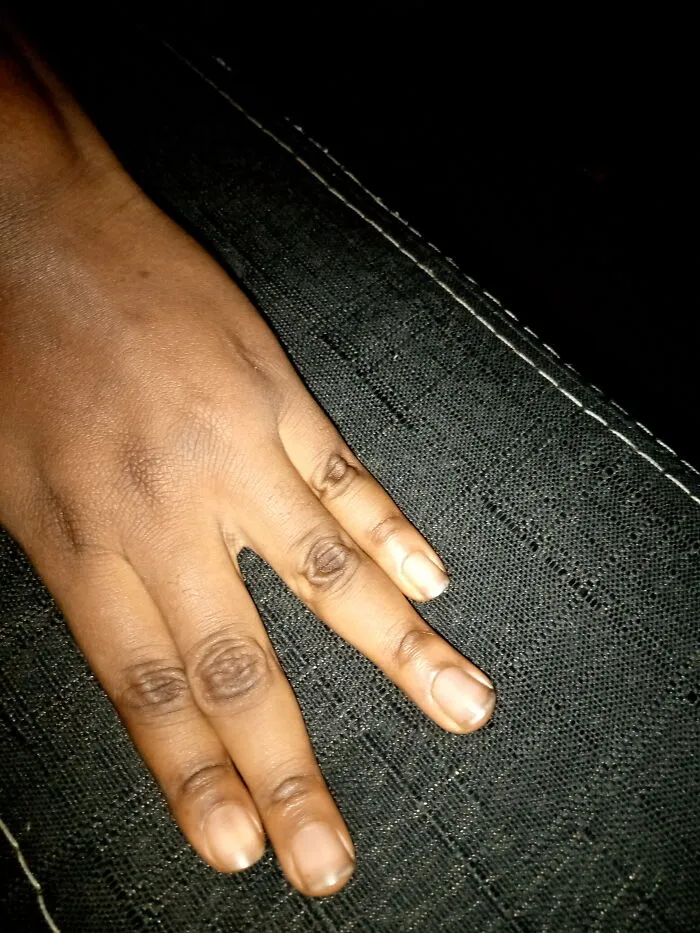 I Don't Know If This Counts, But I Can Separate My Fingers Into Two Groups Quite Voluntarily And Without Stress.