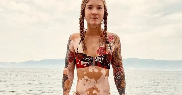 This Woman From Utah Learned To Accept Her Vitiligo Through Fitness And Weightlifting