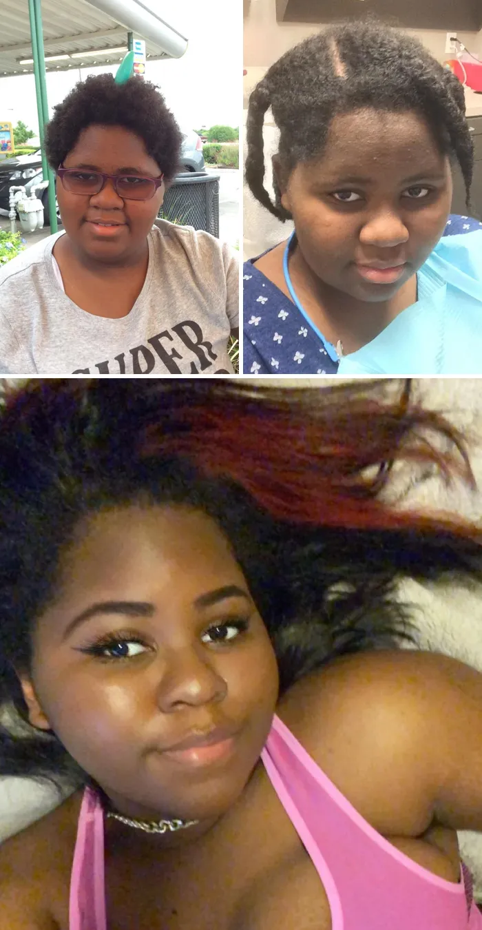 15 -> 16 -> 20. Looking Back At Old Pictures Like, No Wonder I Used To Be So Depressed