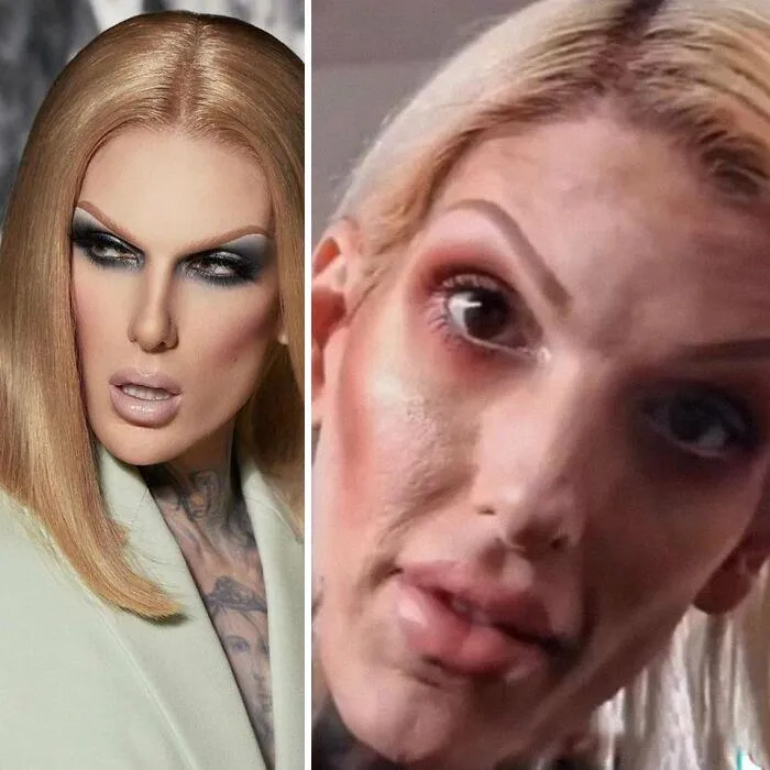 Please Don’t Compare Yourself To Instagram. They Don’t Look Like That In Real Life. Skin Texture Is Normal