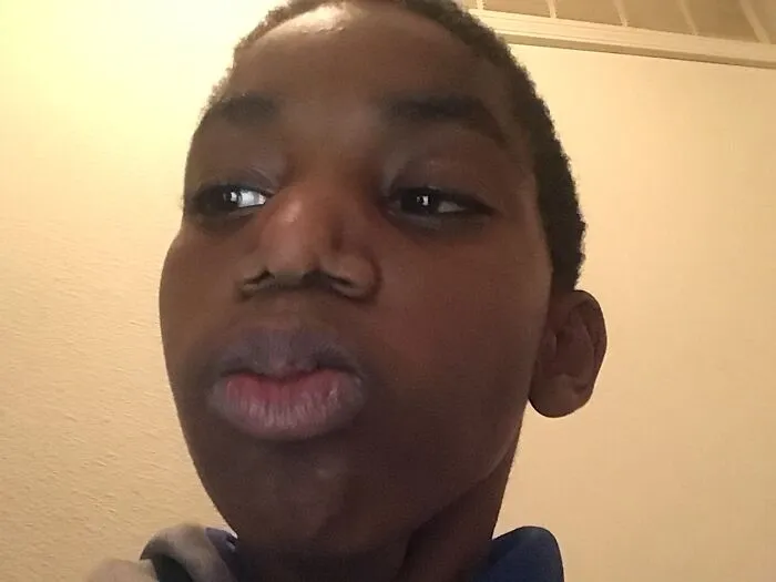 Wierd Nose Trick