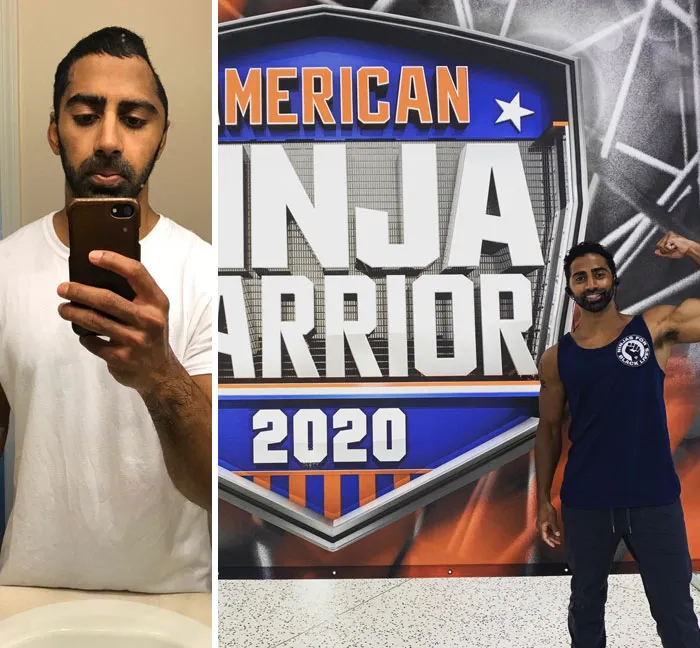 I’ve Gone From A Craniotomy To Ninja Warrior In The Span Of A Year