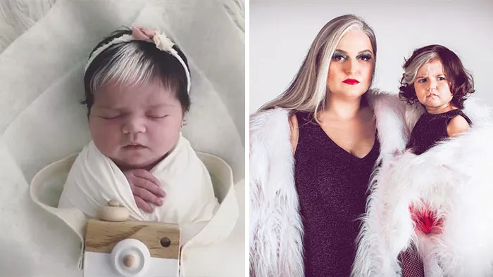 Mother Encourages Her Two-year-old Who Was Born With A White Streak In Her Hair To Embrace Her Uniqueness