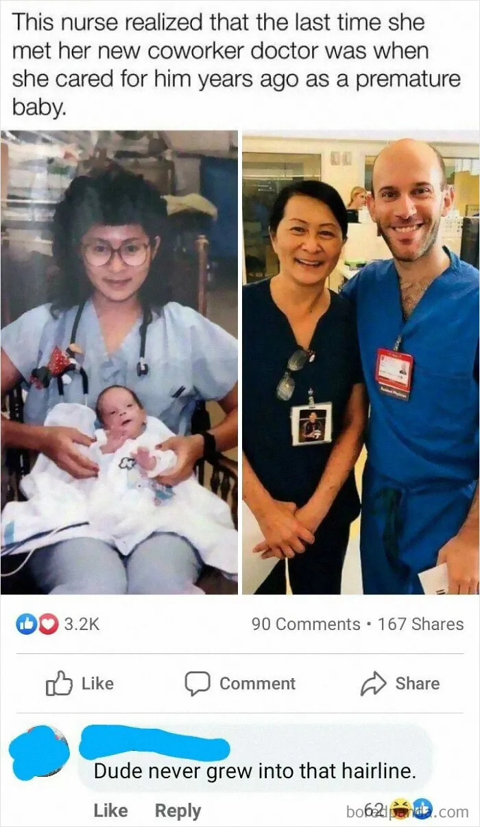 Bald Since Birth