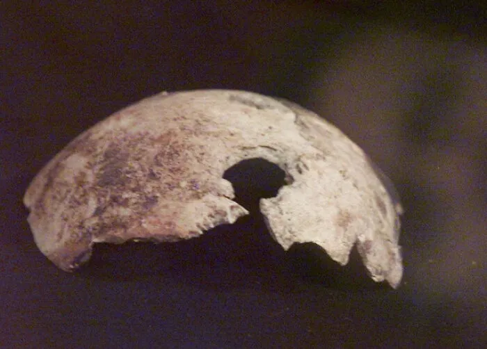 Hitler's Skull Was Fake, Or Someone Else's Skull