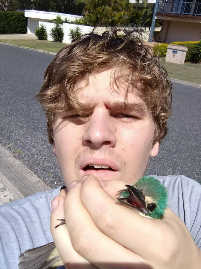 This B***h Ass Just Flew Into My Eye And Fell To The Ground