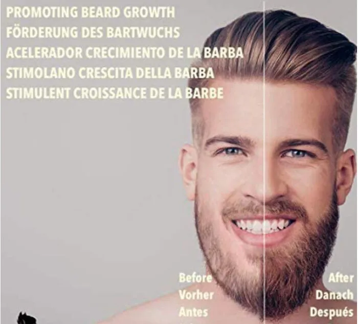 How They Think This Man's "Before" Chin Should Look Like