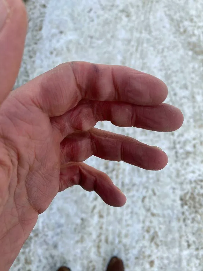 -25 grados. Bolsa de la compra pesada. Sin guantes. Larga reunión/charla con un viejo amigo en el estacionamiento. Gravedad