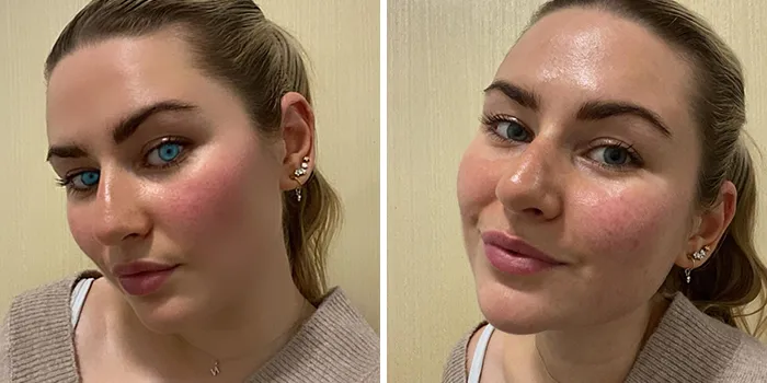 Las mujeres se unen al desafío #FilterDrop en Instagram y comparten 22 rostros sin filtrar para luchar contra el retoque digital en los anuncios de belleza