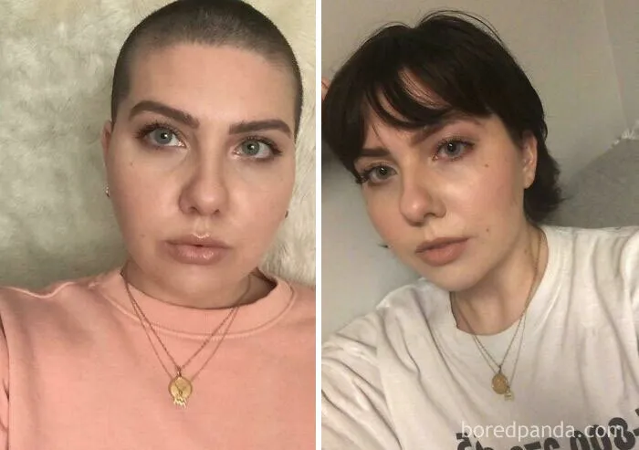 Shy Of 10 Months Of Hair Growth! (And -30lbs)