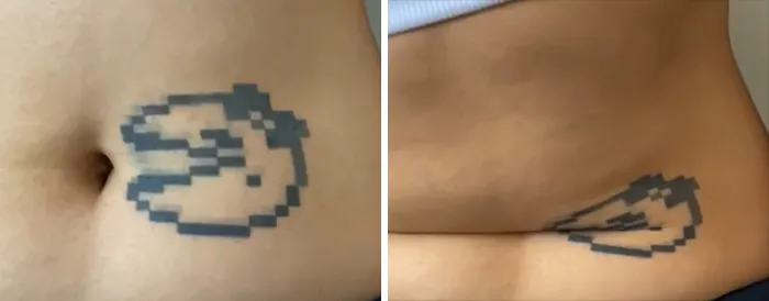 “¿Cuál es el tatuaje más estúpido que te hayas hecho?” Y 30 personas mostraron los suyos